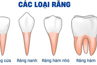 Răng vĩnh viễn là răng nào?