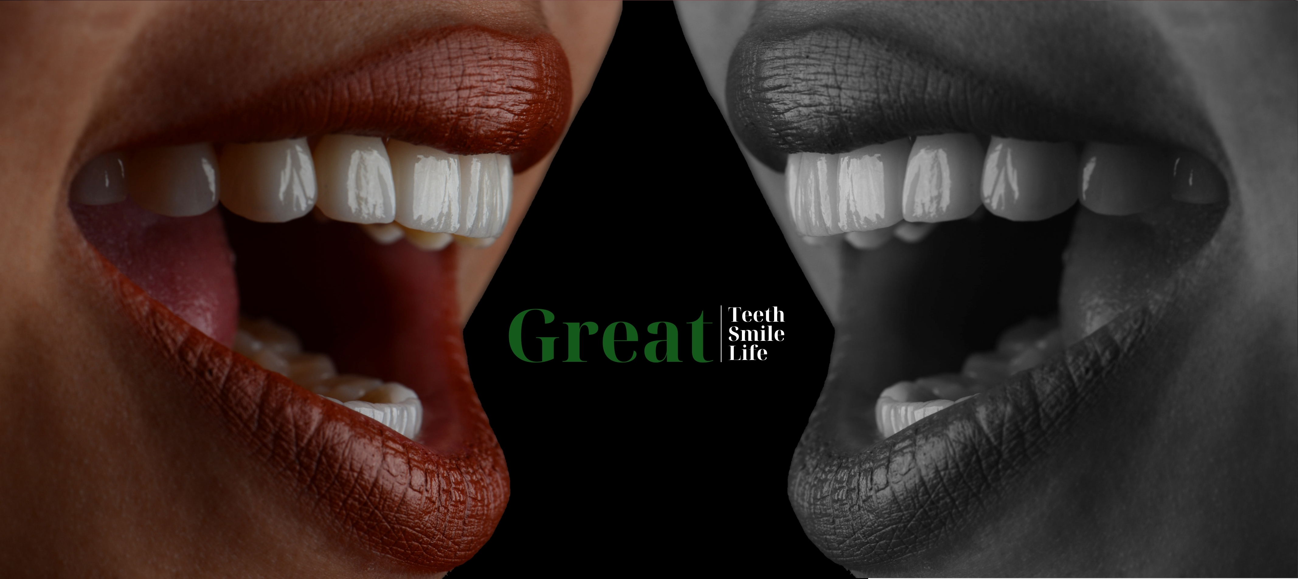 Răng sứ thẩm mỹ